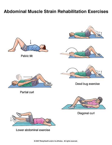 abdominal m. strain