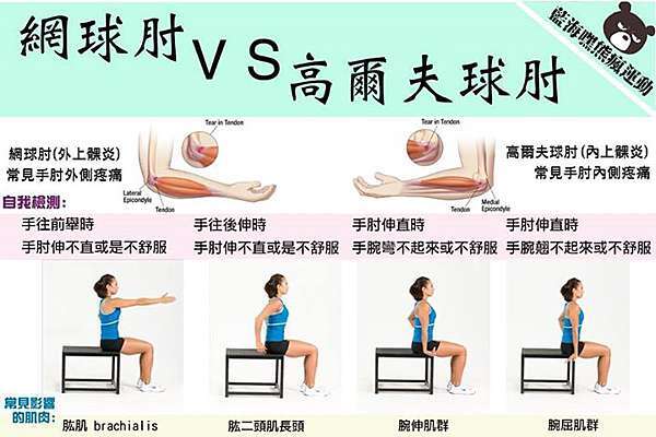 ç¶²çƒè‚˜ï½–ï½