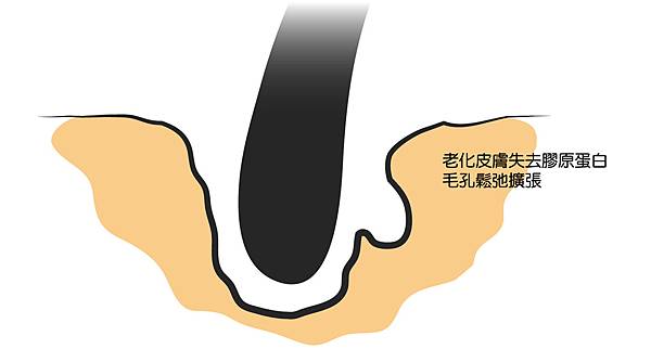 皮秒雷射凹疤皮秒毛孔ptt755皮秒雷射價格蜂巢皮秒雷射ptt皮秒雷射凹洞ptt蜂巢皮秒雷射高雄皮秒雷射03.jpg 皮秒雷射凹疤皮秒毛孔ptt755皮秒雷射價格蜂巢皮秒雷射ptt皮秒雷射凹洞ptt蜂巢皮秒雷射高雄皮秒雷射03.jpg
