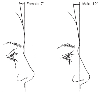 nasofrontal angle