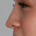 greek nose