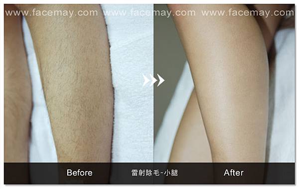 案例.jpg 案例.jpg