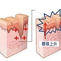 台中拉皮｜4D線雕提拉09.jpg