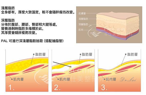 PAL-2-03.jpg PAL-2-03.jpg