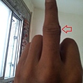 thumb