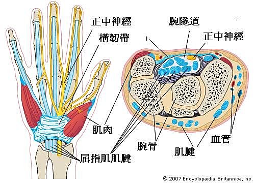 腕隧道症候群