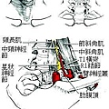 手套式手麻症狀2