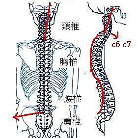 駝背的處理經驗