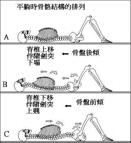 駝背的處理經驗1