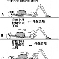 駝背的處理經驗1