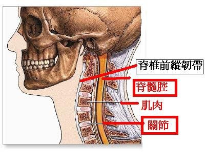 「頸部鞭打症」(Whiplash)1