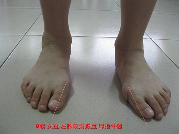 9歲陳女童 9歲陳女童