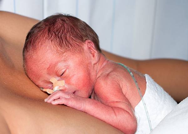 bigstock-Premature-Baby-24861548