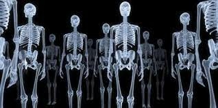 1 X光攝影機，將人體透視成為一具骨架.jpg