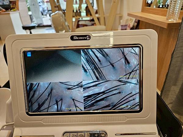 【台南髮廊|台南頭皮護理推薦】頭皮護理＝未來髮質投資？ 💥頭