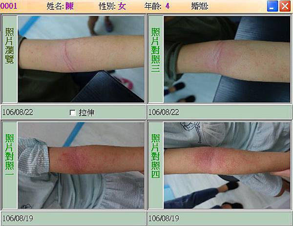 治療圖七.jpg