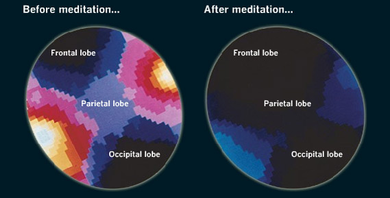Benefits-of-meditation-1-brain-scans Benefits-of-meditation-1-brain-scans