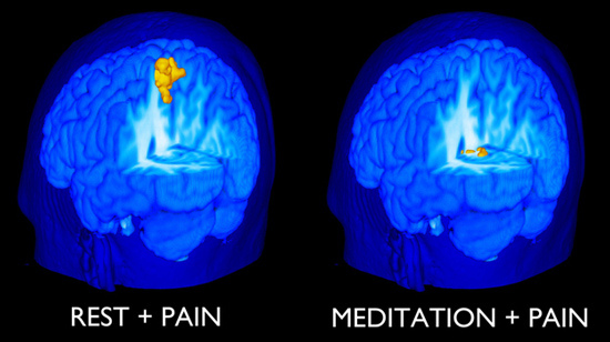 Benefits-of-meditation-2-pain Benefits-of-meditation-2-pain