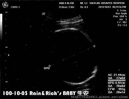 100-10-03 寶寶超音波(生安).jpg