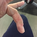 finger_0997.JPG