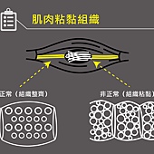 粘黏組織圖-01.jpg