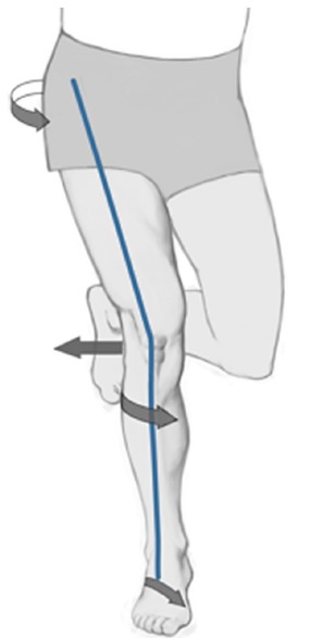 dynamic valgus picture.jpg