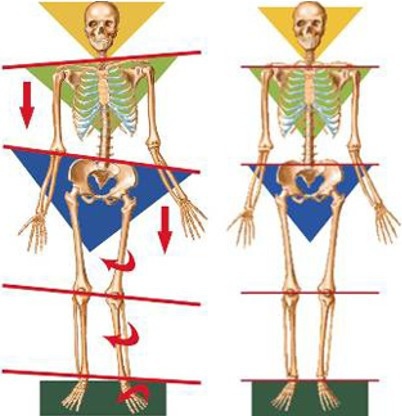 flat foot biomechanics.jpg