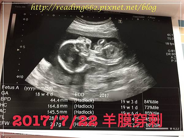 意外之喜~迎接生命中的第三個寶貝3.JPG