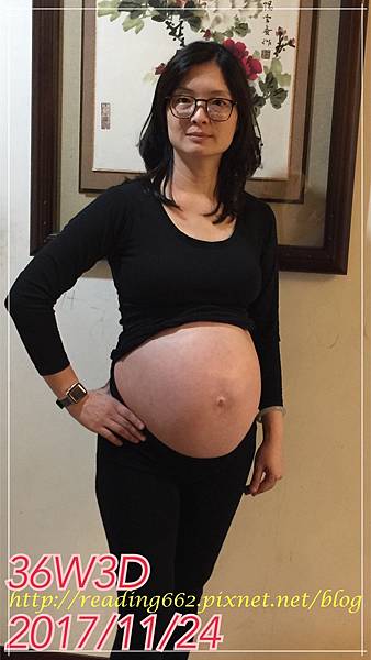 胎位不正的三寶妹1.JPG 胎位不正的三寶妹1.JPG