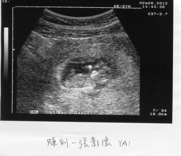 pic04 pic04