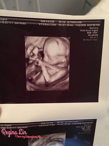 thumb_IMG_6529_1024.jpg thumb_IMG_6529_1024.jpg