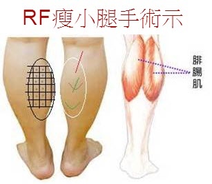 圖片2.jpg