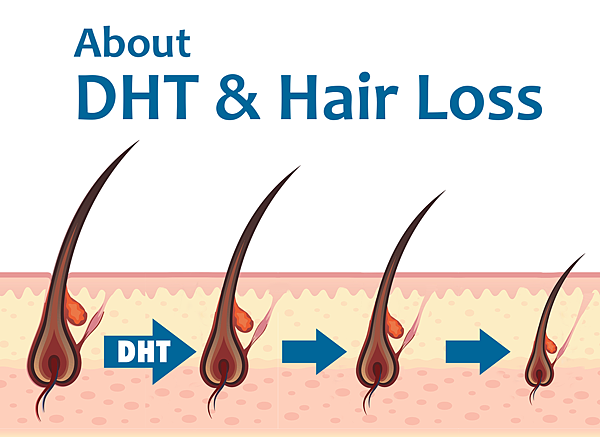 DHT %26; Hair Loss DHT %26; Hair Loss