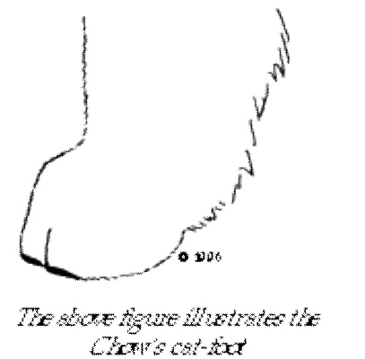 CHOW-12 足趾