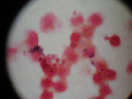 gram stain (1).JPG