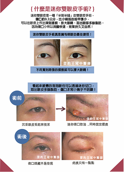 里約診所 王冠中醫師 痞客邦 里約診所 王冠中醫師 痞客邦