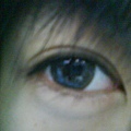 Eye _after