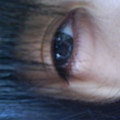 Eye_before