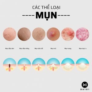 Tế Bào Gốc Trị Mụn DR Pluscell