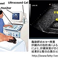 肝腎超音波少掃描