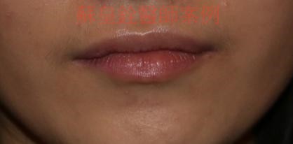 lip