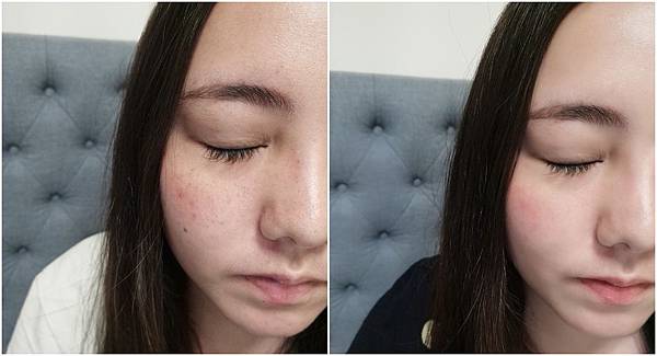 VICHY薇姿15%維他命C超導安瓶,安瓶推薦,維他命C,加強提亮