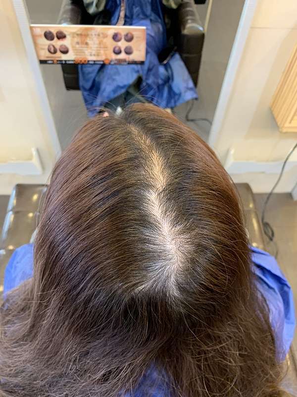 分髪線 髪旋超明顯 讓你看起來像禿頭 Vif美髮沙龍 日本最新魔力薩拉髮流調整護髮天然無藥劑髪流整形還你超美圓弧頭型