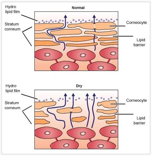 skin-barrier-function-in-normal-and-atopic-skin.jpg