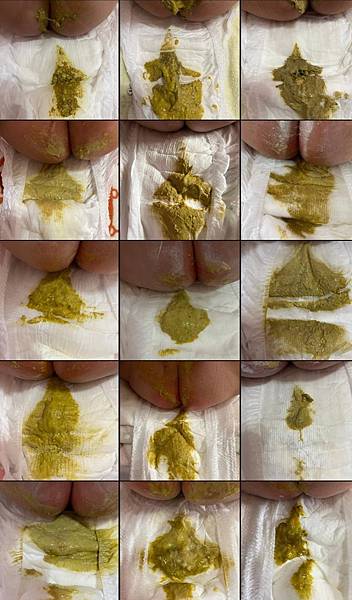 屁葵的拉肚子&紅屁屁破皮之5-6個月的娃生後續之醫生建議事項 屁葵的拉肚子&紅屁屁破皮之5-6個月的娃生後續之醫生建議事項