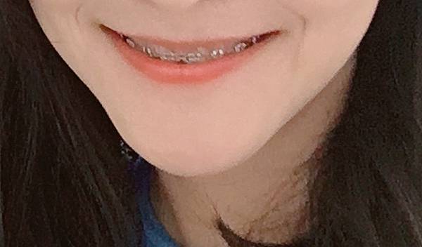 9B52EEAF-7DFA-484D-8157-D0AB62F2CD91.jpg 9B52EEAF-7DFA-484D-8157-D0AB62F2CD91.jpg