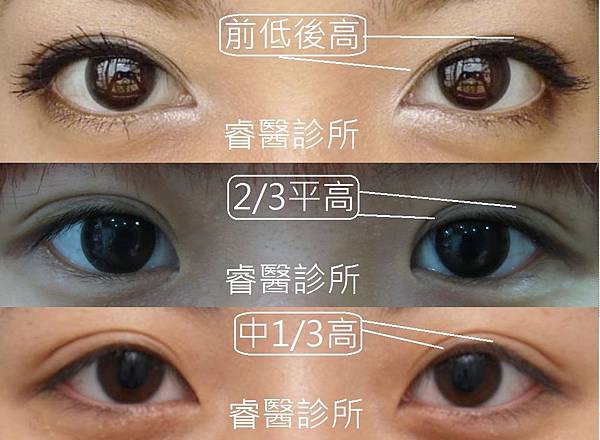 different eye shape1rev.jpg