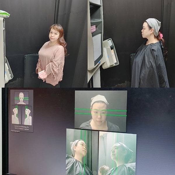 愛美 原來肌膚可以如此好 粉刺無痛bye bye 海菲秀