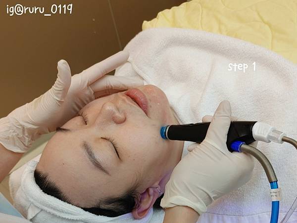 愛美 原來肌膚可以如此好 粉刺無痛bye bye 海菲秀