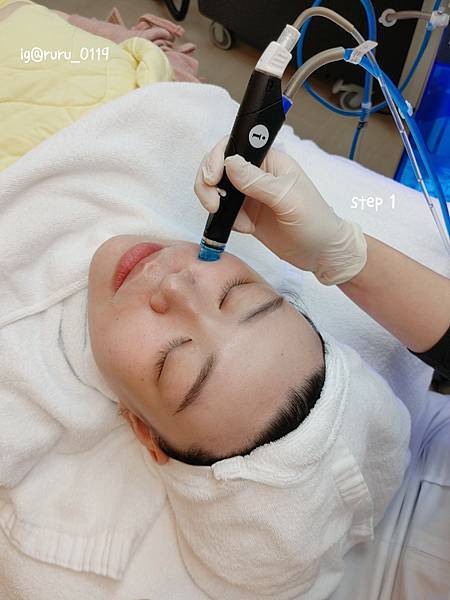 愛美 原來肌膚可以如此好 粉刺無痛bye bye 海菲秀